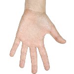 あなたの手に疣贅を取り除く方法