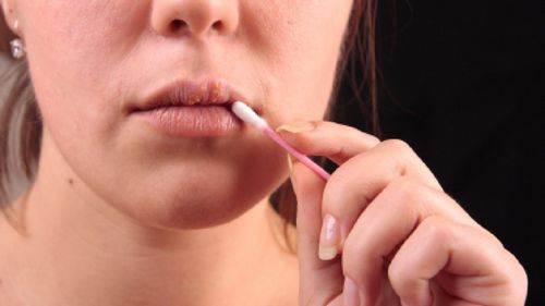 風邪を治療する効果的な方法